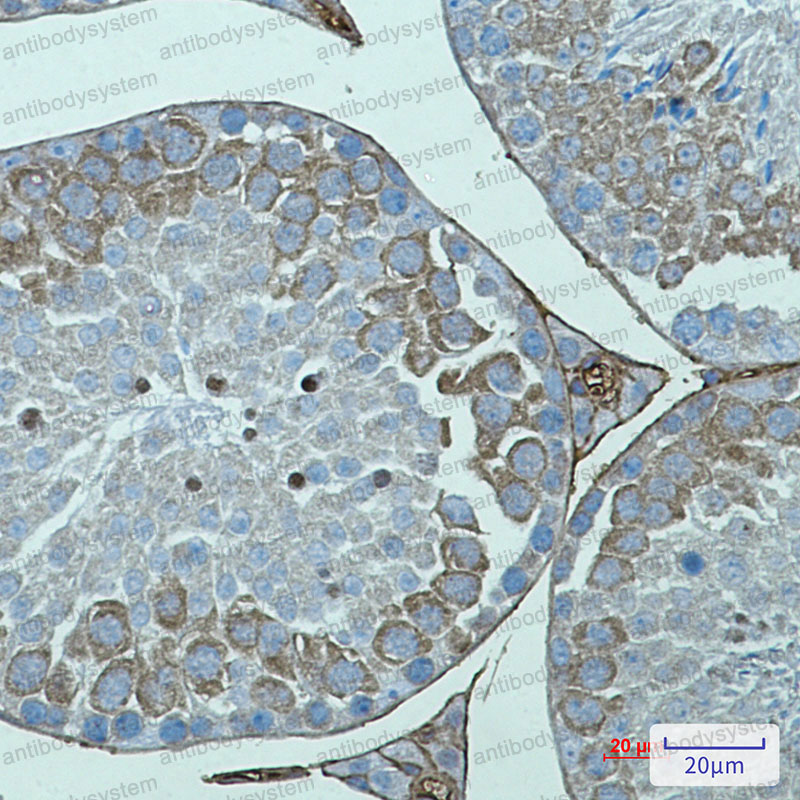 Anti-AVEN Antibody (R2S27)