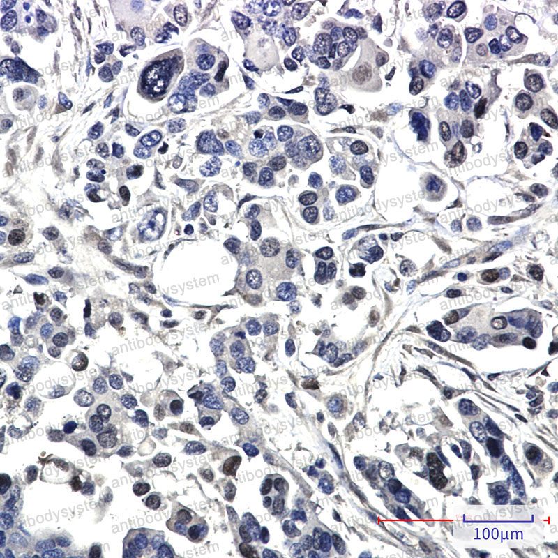 Anti-BAG1 Antibody (R2S28)