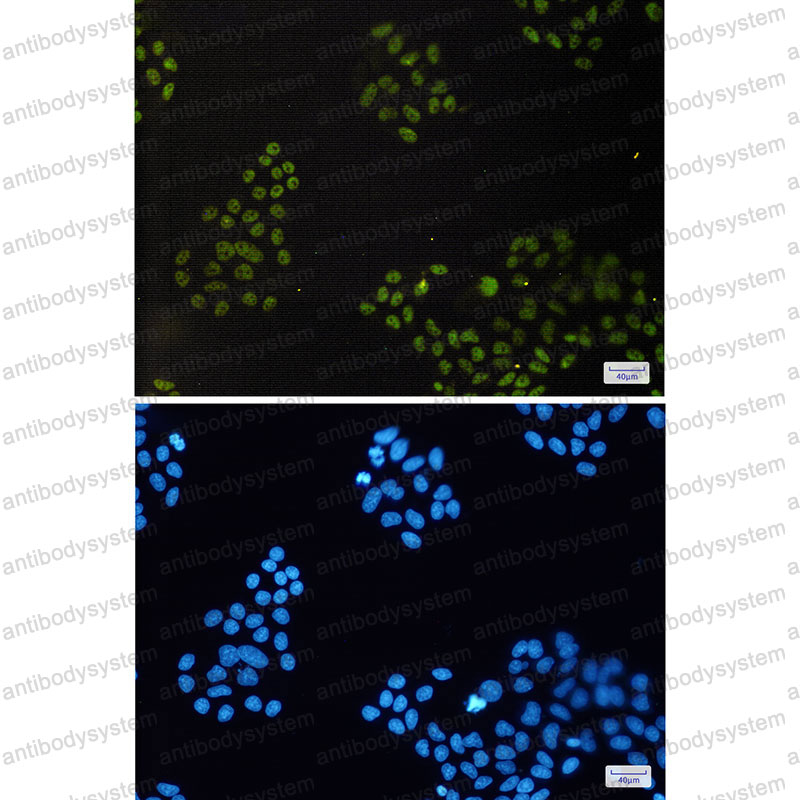 Anti-CXXC1 Antibody (R2S31)