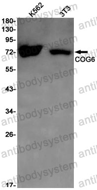 Anti-COG6 Antibody (R2S32)