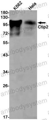 Anti-BCL11B Antibody (R2S33)