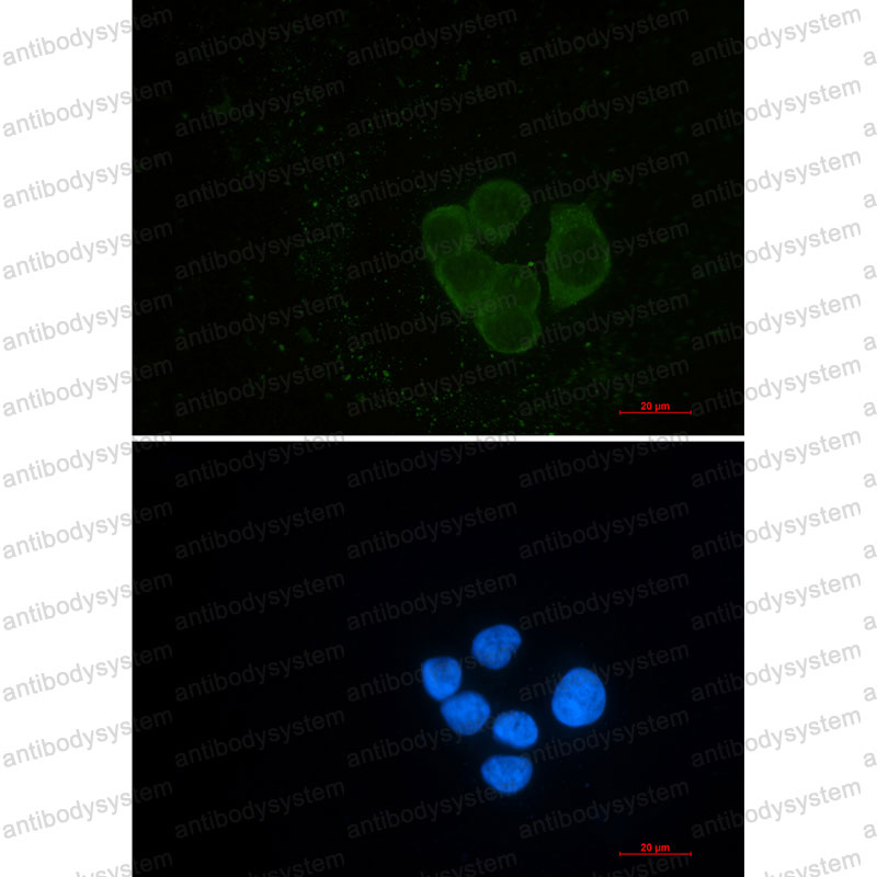 Anti-EPS15L1 Antibody (R2S46)