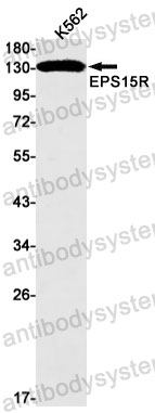 Anti-EPS15L1/EPS15R Antibody (R2S45)