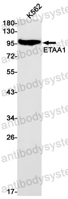 Anti-ETAA1 Antibody (R2S47)