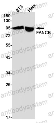 Anti-FANCB Antibody (R2S49)