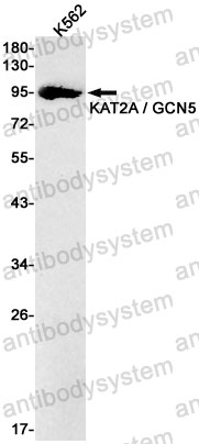 Anti-KAT2A Antibody (R2S50)