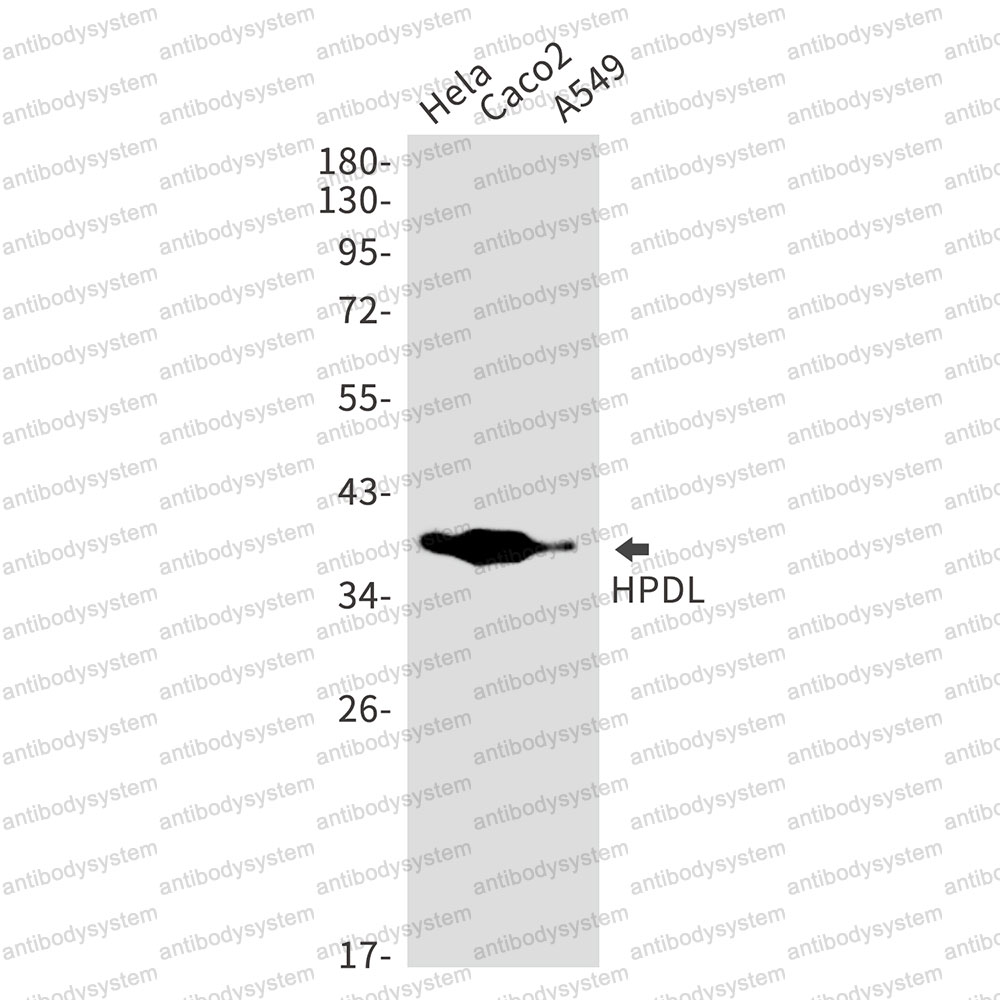 Anti-HPDL Antibody (R2S51)