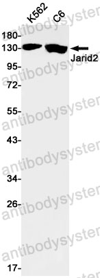 Anti-JARID2 Antibody (R2S52)