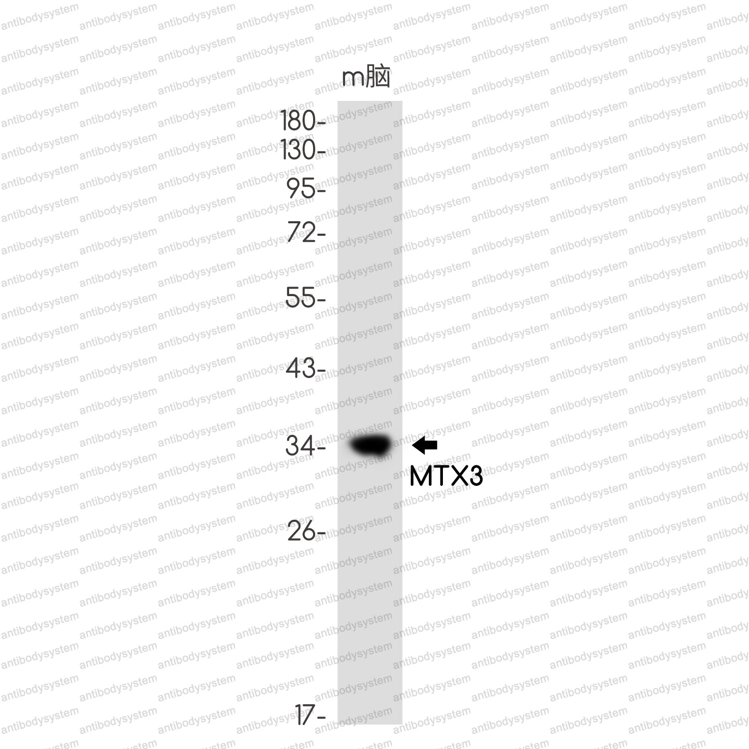 Western blot for Anti-MTX3 Antibody (R2S58) ?>
