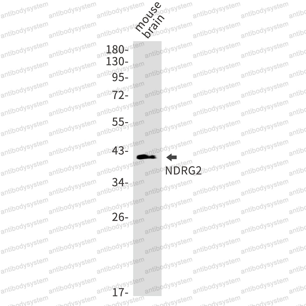 Western blot for Anti-NDRG2 Antibody (R2S61) ?>