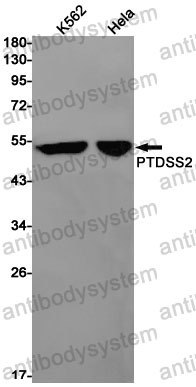 Western blot for Anti-PTDSS2 Antibody (R2S69) ?>