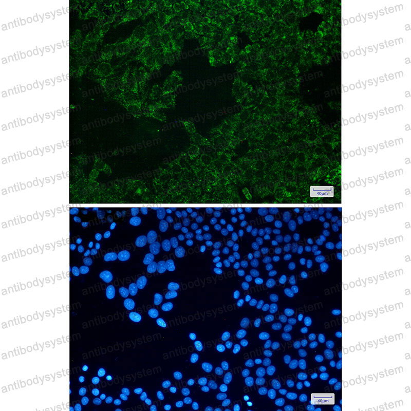 Immunofluorescence for Anti-SEC61A2 Antibody (R2S74) ?>