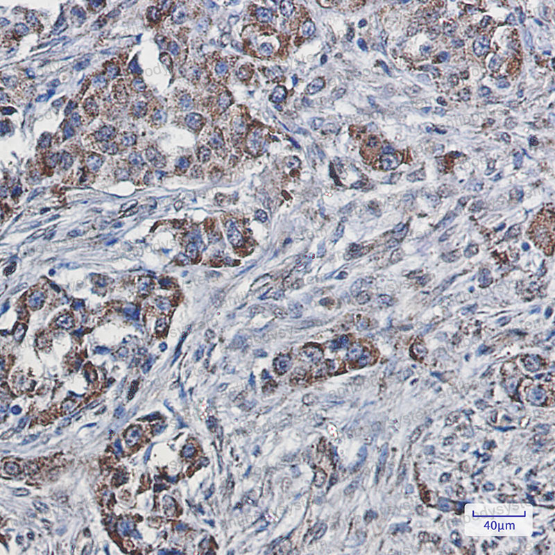 Immunohistochemical for Anti-SEC61A2 Antibody (R2S74) ?>