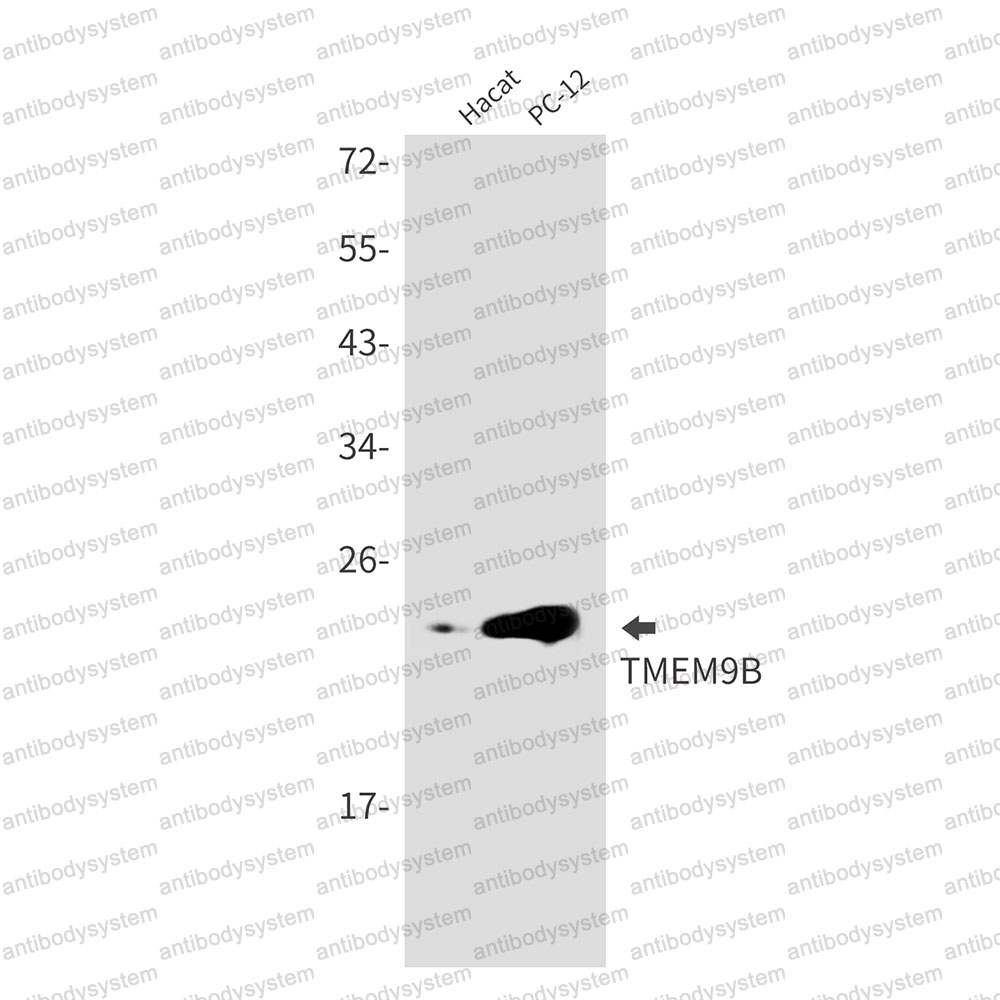 Western blot for Anti-TMEM9B Antibody (R2S78) ?>