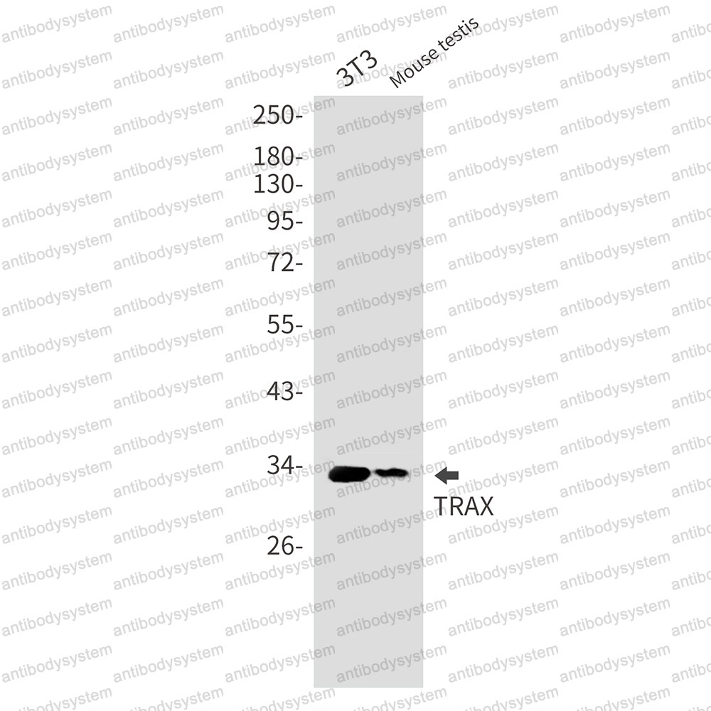 Western blot for Anti-TSNAX Antibody (R2S79) ?>