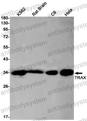 Western blot for Anti-TSNAX Antibody (R2S79) ?>