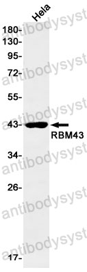 Western blot for Anti-RBM43 Antibody (R2S85) ?>