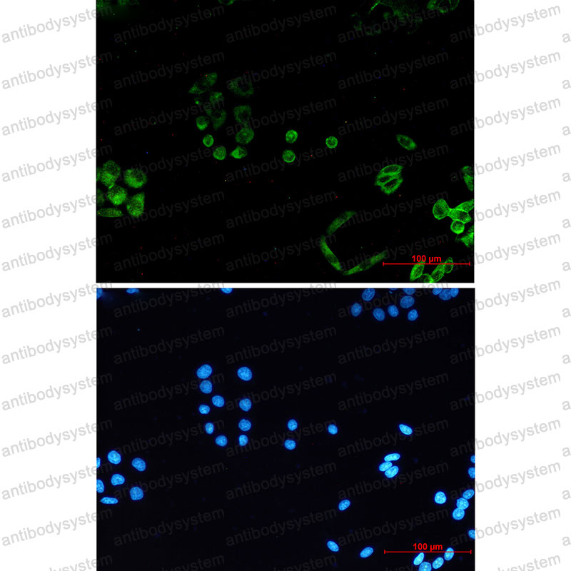 Immunofluorescence for Anti-PACSIN3 Antibody (R2S86) ?>