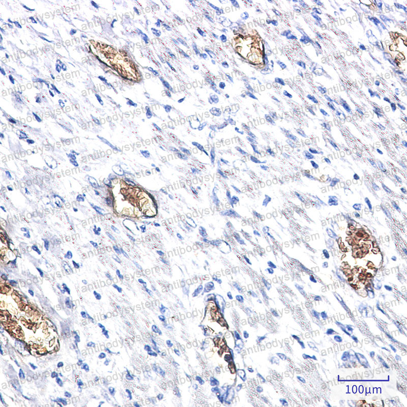 Immunohistochemical for Anti-PACSIN3 Antibody (R2S86) ?>