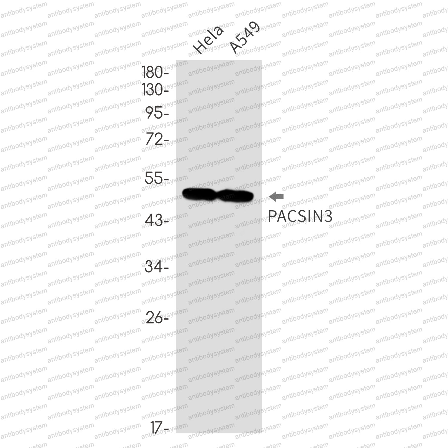Western blot for Anti-PACSIN3 Antibody (R2S86) ?>