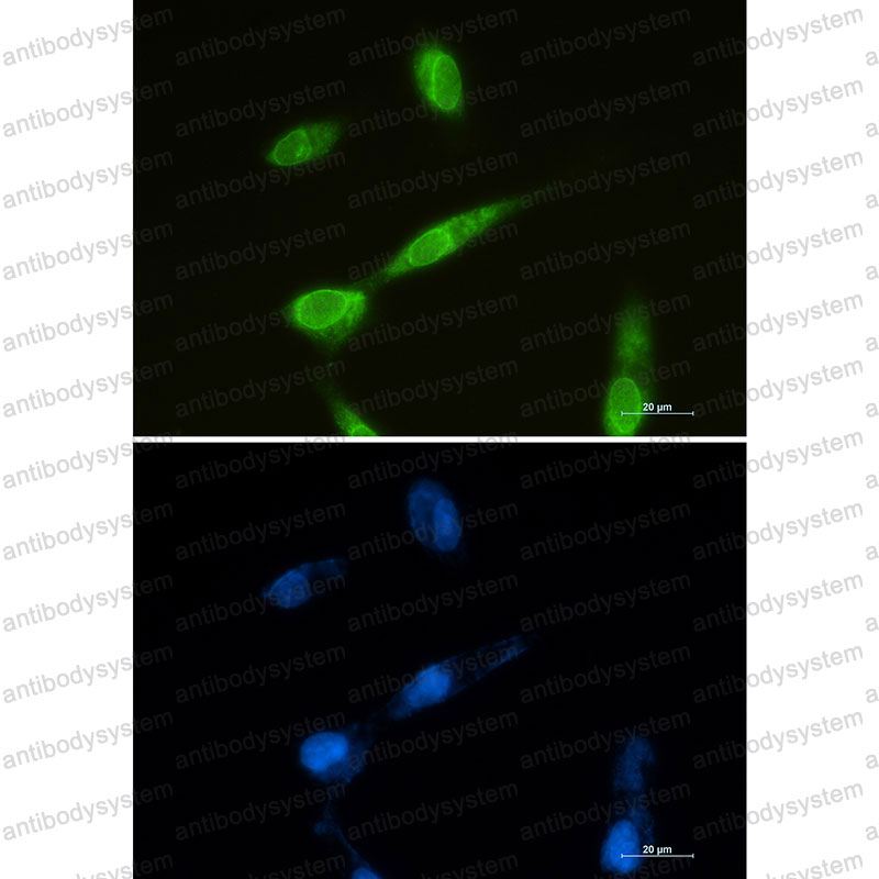 Immunofluorescence for Anti-MTDH Antibody (R2S98) ?>