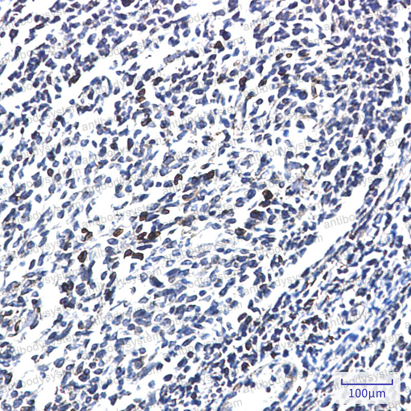 Immunohistochemical for Anti-MTDH Antibody (R2S98) ?>