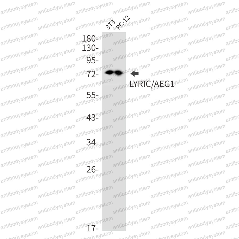 Western blot for Anti-MTDH Antibody (R2S98) ?>