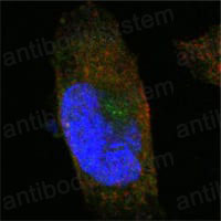 Anti-SORL1 Antibody (R4A72)
