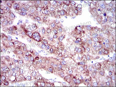 Anti-SLC27A5 Antibody (R4C20)