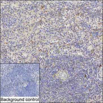 Anti-IKZF2 Antibody (R4D02)
