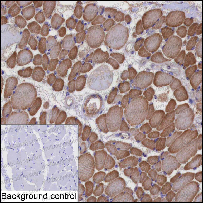 Anti-NT5C1A Antibody (R4D14)