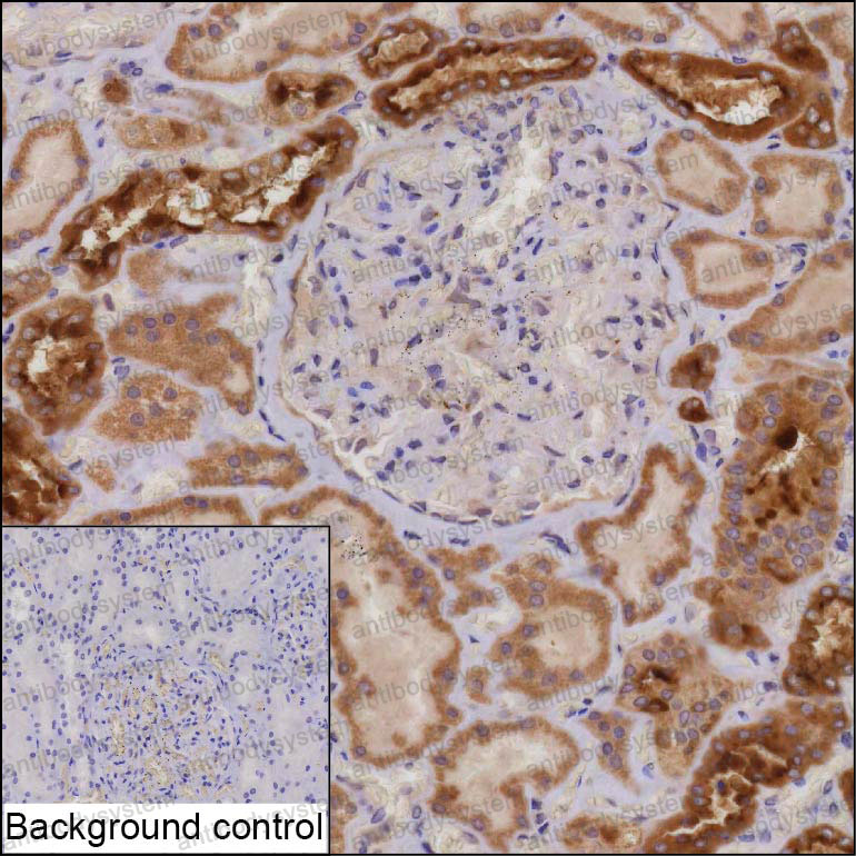 Anti-TRIM47 Antibody (R4D29)