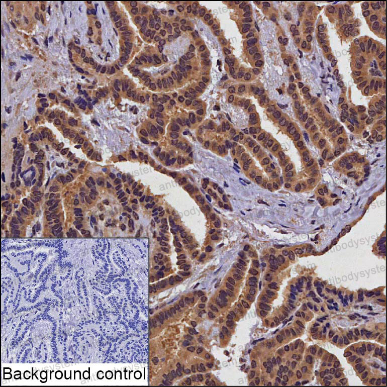 Anti-FBXO34 Antibody (R4D31)