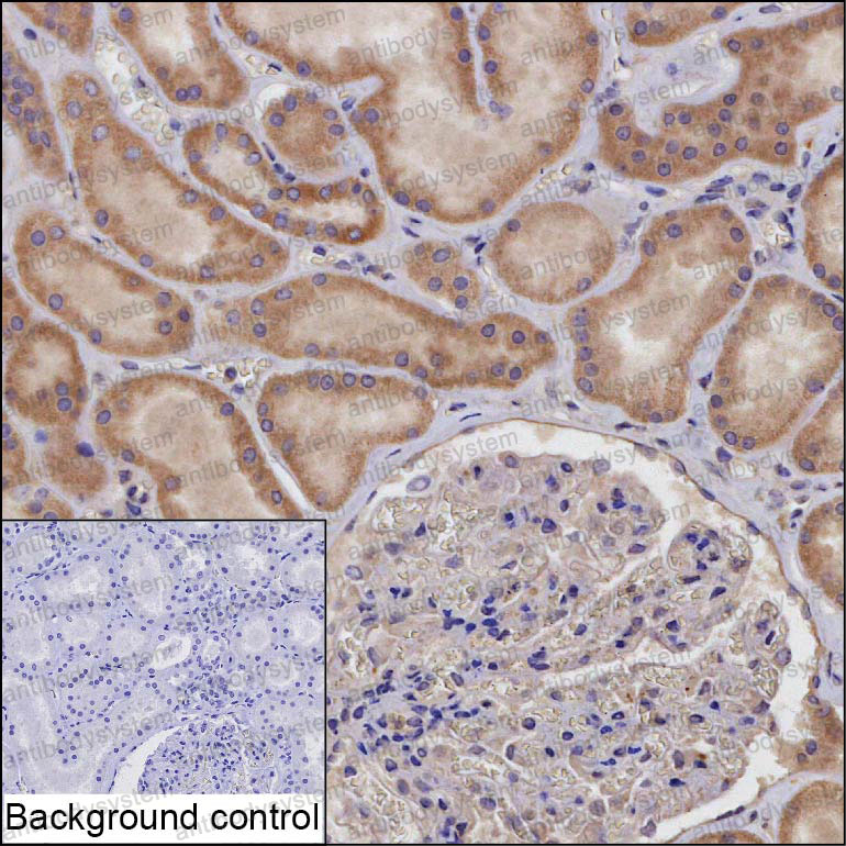 Anti-NDUFAF2 Antibody (R4D32)