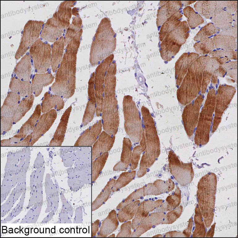 Anti-PPP1R27 Antibody (R4D33)