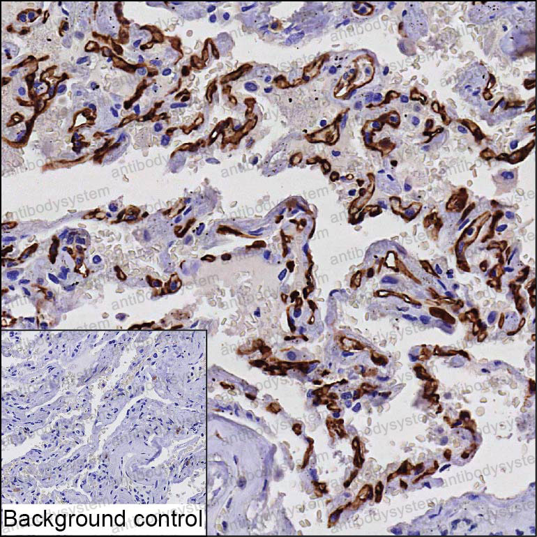 Anti-PRX Antibody (R4D35)