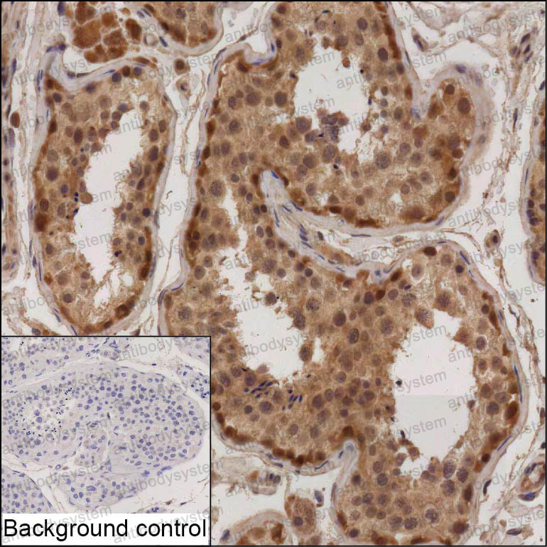 Anti-RNF212B Antibody (R4D36)