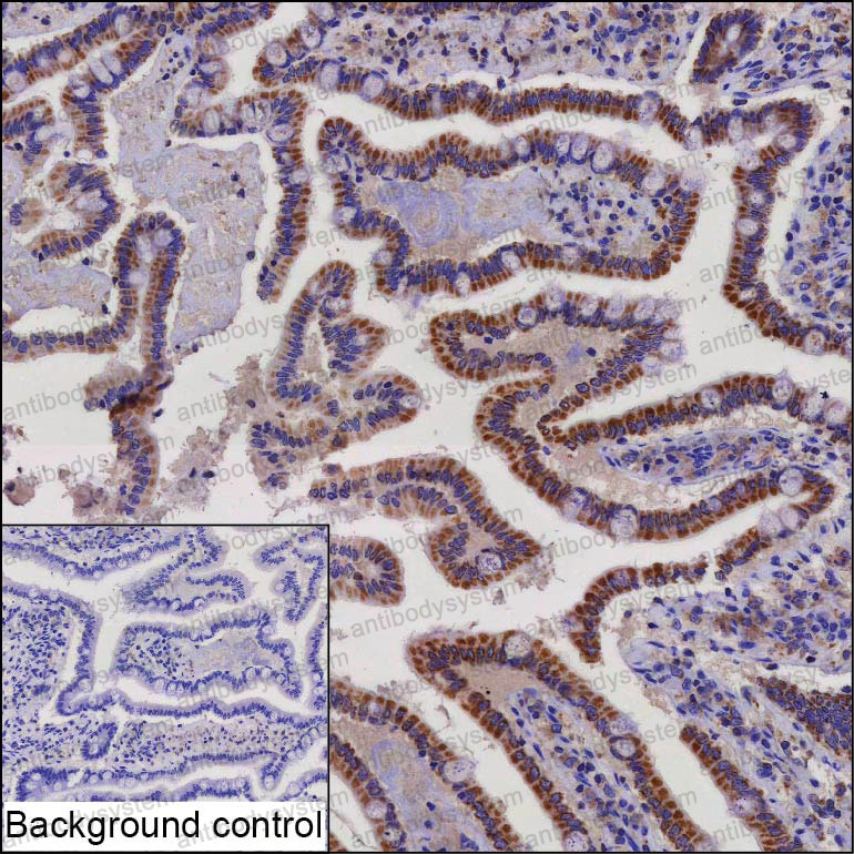 Anti-SAMD13 Antibody (R4D38)