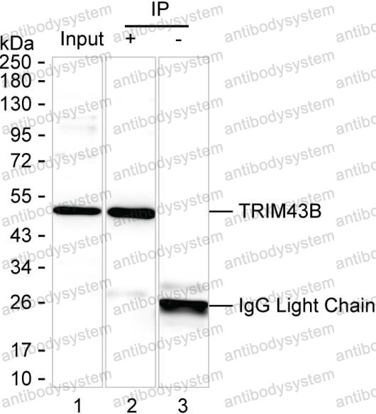 Anti-TRIM43B Antibody (R4D39)