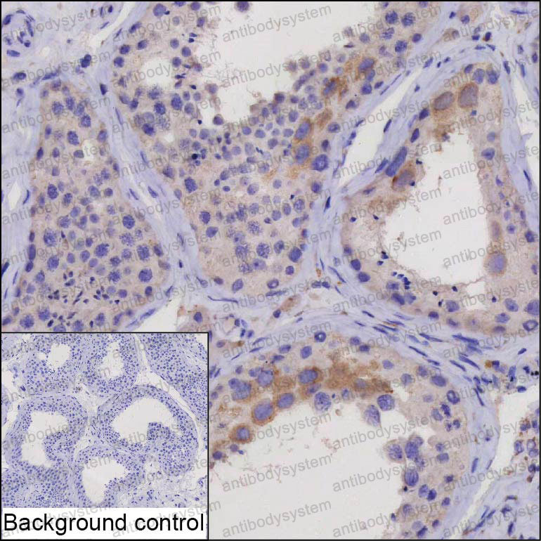 Anti-CXorf49 Antibody (R4D44)