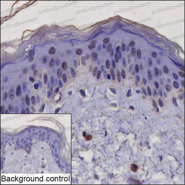Anti-POU2F3 Antibody (R4D45)