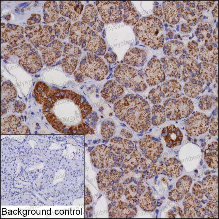 Anti-VPS53 Antibody (R4D46)