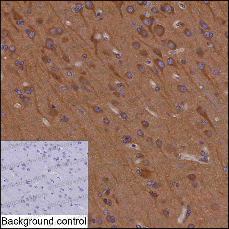 Anti-RNF19A Antibody (R4D47)