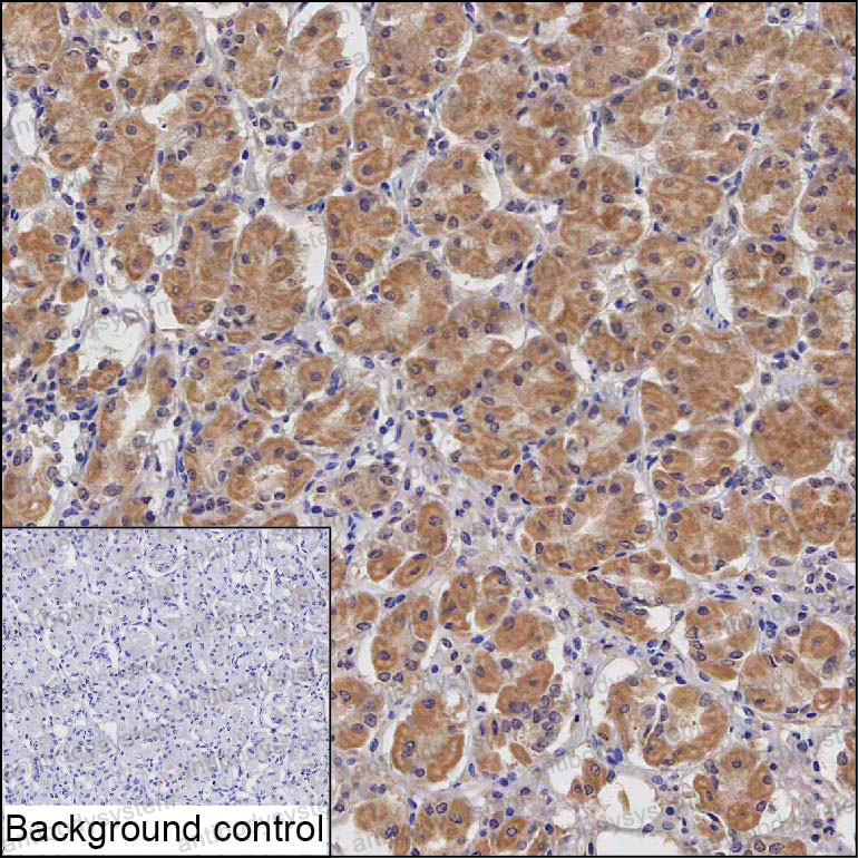 Anti-CCDC140 Antibody (R4D48)