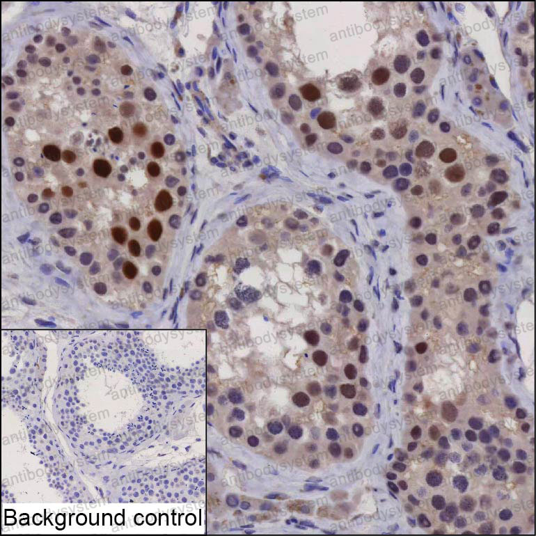 Anti-EFCAB10 Antibody (R4D49)