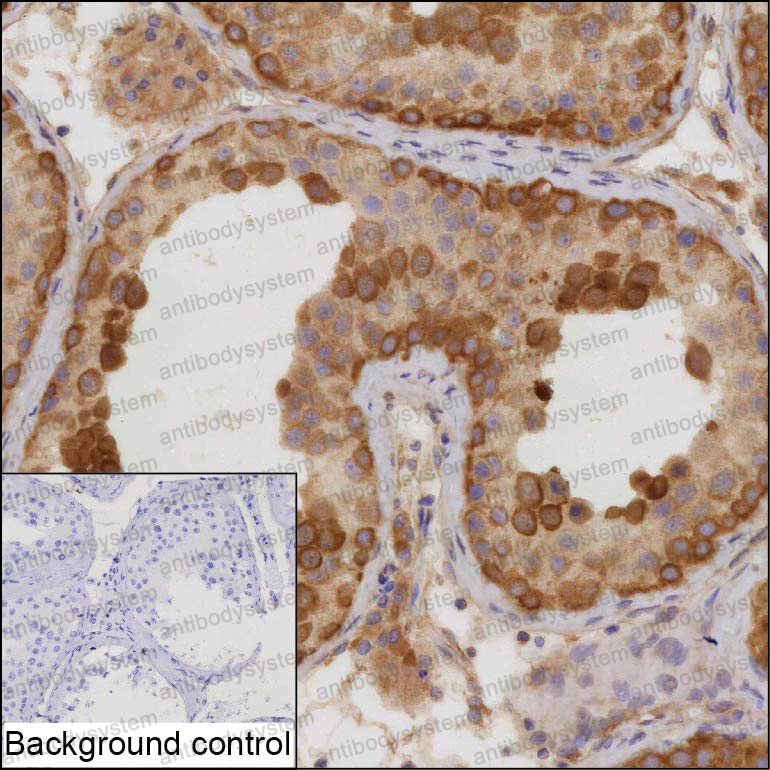 Anti-AARSD1 Antibody (R4D53)