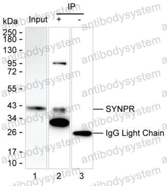 Anti-SYNPR Antibody (R4D57)