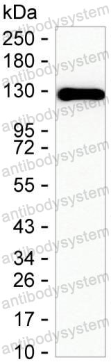 Anti-PPP1R9B Antibody (R4D65)
