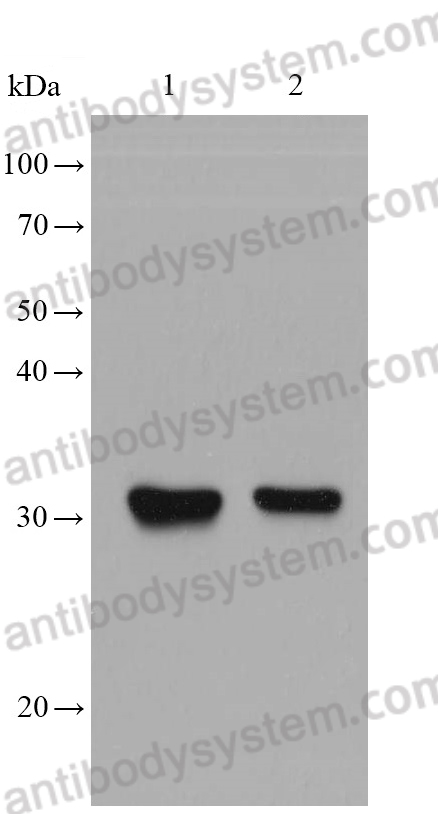 Anti-SLC39A3/ZIP3 Antibody (m1Y05)