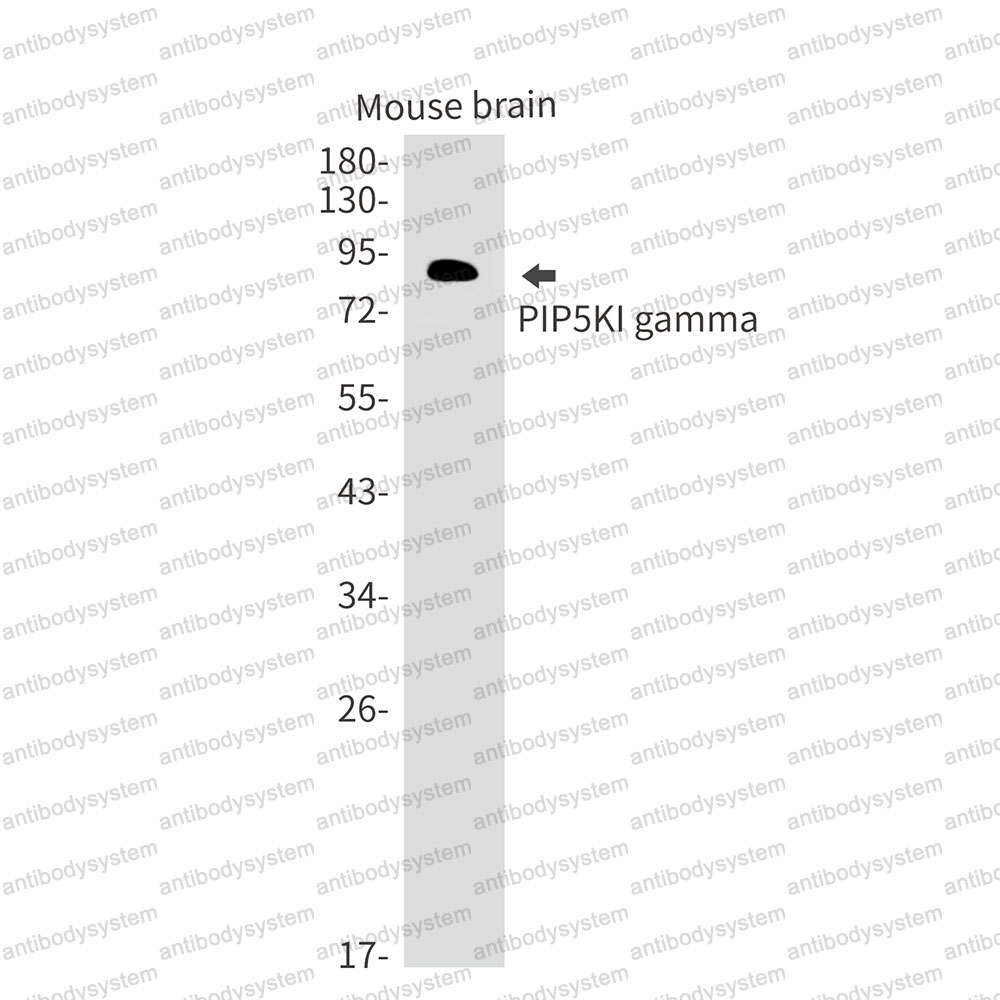 Anti-PIP5K1C Antibody (R1E52)